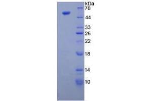 SDS-PAGE analysis of Human Tubulin beta 3 Protein. (TUBB3 Protein)