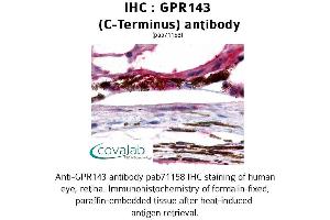 Image no. 1 for anti-G Protein-Coupled Receptor 143 (GPR143) (C-Term) antibody (ABIN1734946) (GPR143 antibody  (C-Term))