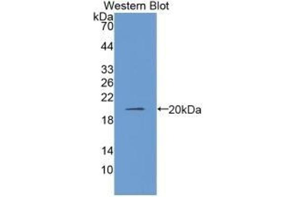 COL8A1 antibody  (AA 575-743)
