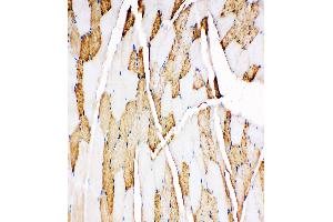Anti-Myoglobin antibody, IHC(P) IHC(P): Rat Skeletal Muscle Tissue (Myoglobin antibody  (C-Term))
