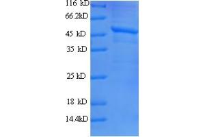 SDS-PAGE (SDS) image for Janus Kinase 2 (JAK2) (AA 752-1132), (partial) protein (His tag) (ABIN5709779) (JAK2 Protein (AA 752-1132, partial) (His tag))