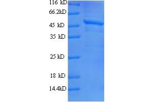 SDS-PAGE (SDS) image for Janus Kinase 2 (JAK2) (AA 752-1132), (partial) protein (His tag) (ABIN5709779)