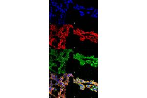 Immunocytochemistry/Immunofluorescence analysis using Mouse Anti-7-Ketocholesterol Monoclonal Antibody, Clone 7E1 . (7-Ketocholesterol (7-KC) antibody (HRP))