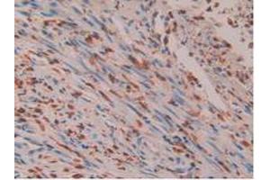 Figure. (IL16 antibody  (AA 1203-1332))