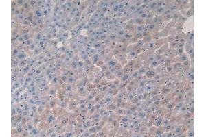 IHC-P analysis of Mouse Liver Tissue, with DAB staining. (IL-2 antibody  (AA 10-169))