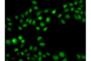Immunofluorescence analysis of A549 cell using SULT2B1 antibody. (SULT2B1 antibody)