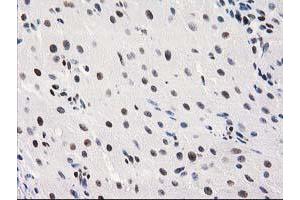 Immunohistochemical staining of paraffin-embedded Human Ovary tissue using anti-MEF2C mouse monoclonal antibody. (MEF2C antibody)