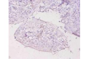 Immunohistochemistry of paraffin-embedded human tonsil tissue using ABIN7159517 at dilution of 1:20