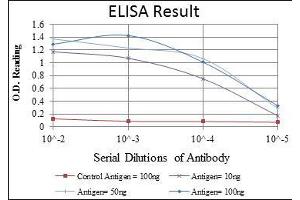 Red: Control Antigen (100 ng), Purple: Antigen (10 ng), Green: Antigen (50 ng), Blue: Antigen (100 ng), (FOXP2 antibody)