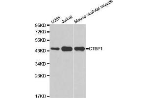 Western blot analysis of extracts of various cell lines, using CTBP1 antibody.
