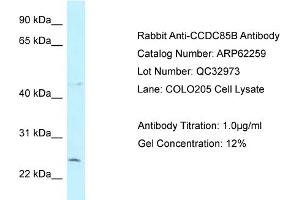 Western Blotting (WB) image for anti-Coiled-Coil Domain Containing 85B (CCDC85B) (N-Term) antibody (ABIN2789085) (CCDC85B antibody  (N-Term))