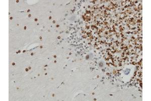 Immunoperoxidase of monoclonal antibody to TPR on formalin-fixed paraffin-embedded human cerebellum. (TPR antibody  (AA 1-98))