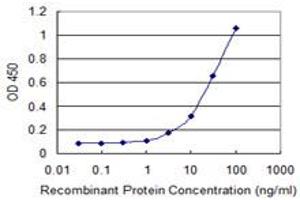 Detection limit for recombinant GST tagged SIRT6 is 1 ng/ml as a capture antibody. (SIRT6 antibody  (AA 141-250))