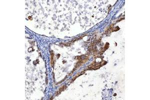 IHC analysis of SUMF2 using anti-SUMF2 antibody (ABIN7600954). (SUMF2 antibody  (AA 26-301))