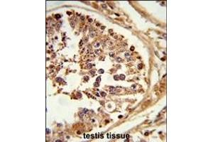 Formalin-fixed and paraffin-embedded human testis tissue reacted with LIPE Antibody (C-term) (ABIN653323 and ABIN2842814) , which was peroxidase-conjugated to the secondary antibody, followed by DAB staining. (LIPE antibody  (C-Term))