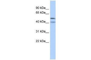 Western Blot showing ZNF566 antibody used at a concentration of 1-2 ug/ml to detect its target protein. (ZNF566 antibody  (Middle Region))