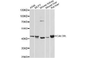 Western blot analysis of extracts of various cell lines, using CALCRL antibody. (CALCRL antibody)