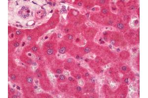 Immunohistochemistry (Paraffin-embedded Sections) (IHC (p)) image for anti-Adrenergic, Beta, Receptor Kinase 1 (ADRBK1) (AA 2-221) antibody (Biotin) (ABIN2604667)