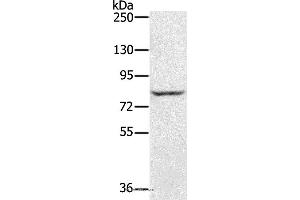 Western blot analysis of Jurkat cell, using RNF43 Polyclonal Antibody at dilution of 1:300 (RNF43 antibody)