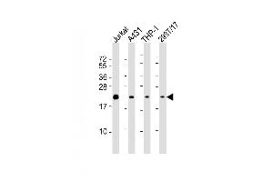 Lane 1: Jurkat Cell lysates, Lane 2: A431 Cell lysates, Lane 3: THP-1 Cell lysates, Lane 4: 293T/17 Cell lysates, probed with BID (1519CT649. (BID antibody)