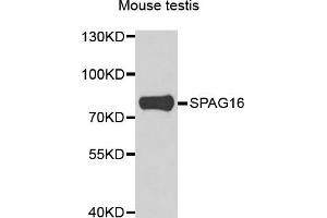 Western blot analysis of extracts of mouse testis, using SPAG16 antibody. (SPAG16 antibody)