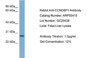 WB Suggested Anti-CCNDBP1  Antibody Titration: 0. (CCNDBP1 antibody  (Middle Region))