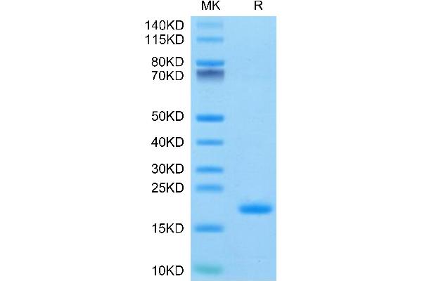 ENPP3 Protein (AA 48-157) (His-Avi Tag)