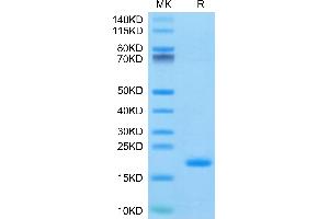ENPP3 Protein (AA 48-157) (His-Avi Tag)