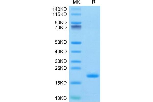 ENPP3 Protein (AA 48-157) (His-Avi Tag)