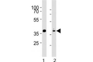 Western blot analysis of lysate from mouse stomach, rat heart tissue (left to right) using Mouse Nkx2. (NK2 Homeobox 5 antibody  (AA 192-225))