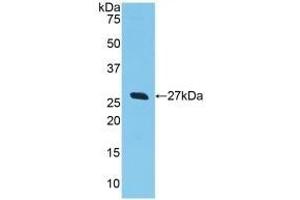 Detection of Recombinant GSTa2, Human using Polyclonal Antibody to Glutathione S Transferase Alpha 2 (GSTa2) (GSTa2 antibody  (AA 1-222))
