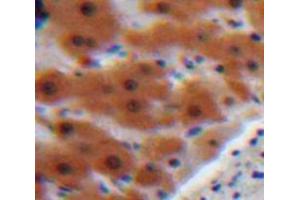 Used in DAB staining on fromalin fixed paraffin-embedded Liver tissue (AGT antibody  (AA 23-477))
