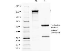 SDS-PAGE Analysis Purified PTH Mouse Monoclonal Antibody (PTH/1173).
