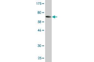Western Blot detection against Immunogen (72. (KRT23 antibody  (AA 1-422))