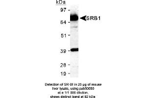 SCARB1 antibody  (C-Term)