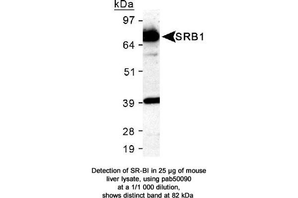 SCARB1 antibody  (C-Term)