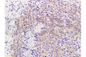 Immunohistochemistry (Paraffin-embedded Sections) (IHC (p)) image for anti-Mitogen-Activated Protein Kinase Kinase Kinase 8 (MAP3K8) (AA 121-220) antibody (ABIN701275)