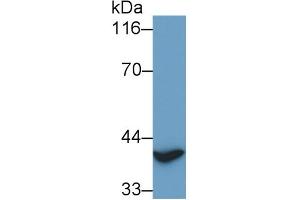 Detection of TITF1 in Rat Heart lysate using Polyclonal Antibody to Thyroid Transcription Factor 1 (TITF1) (NKX2-1 antibody)