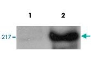 HeLa cells were transfected with CHD5 and analysed by Western blot. (CHD5 antibody)