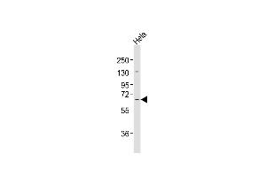 Anti-MLLT1 Antibody at 1:2000 dilution + Hela whole cell lysates Lysates/proteins at 20 μg per lane. (MLLT1 antibody  (C-Term))