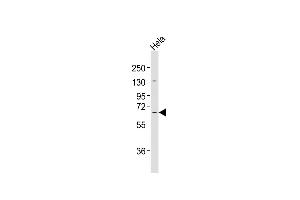 Anti-MLLT1 Antibody at 1:2000 dilution + Hela whole cell lysates Lysates/proteins at 20 μg per lane.