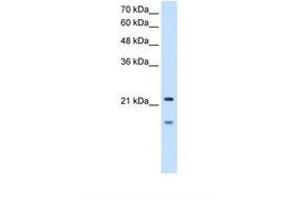 Image no. 1 for anti-Matrix Metallopeptidase 7 (Matrilysin, Uterine) (MMP7) (C-Term) antibody (ABIN321032) (MMP7 antibody  (C-Term))
