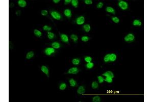 Immunofluorescence of monoclonal antibody to SIX4 on HeLa cell. (SIX4 antibody  (AA 672-780))