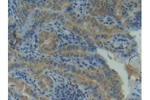 Immunohistochemistry (IHC) image for anti-Heat Shock Protein 90kDa alpha (Cytosolic), Class A Member 1 (HSP90AA1) (AA 698-732) antibody (ABIN7443815)