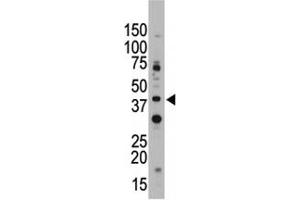 CD33 antibody used in western blot to detect CD33 in Jurkat cell lysate. (CD33 antibody  (AA 12-39))
