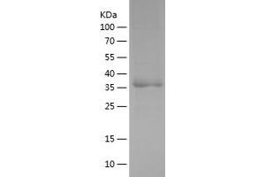 Western Blotting (WB) image for Growth Differentiation Factor 9 (GDF9) (AA 320-454) protein (His-IF2DI Tag) (ABIN7281906) (GDF9 Protein (AA 320-454) (His-IF2DI Tag))