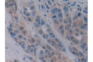 Immunohistochemistry (IHC) image for anti-Choline O-Acetyltransferase (CHAT) (AA 517-732) antibody (ABIN7440704)