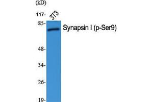 Western Blot (WB) analysis of specific cells using Phospho-Synapsin I (S9) Polyclonal Antibody. (SYN1 antibody  (pSer9))