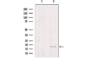 Western blot analysis of extracts from HepG2, using TP53I11 Antibody. (TP53I11 antibody  (N-Term))