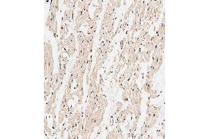Immunohistochemical analysis of paraffin-embedded human heart tissue using (ABIN1538329 and ABIN2849397) performed on the Leica® BOND RXm. (CALCRL antibody  (AA 340-367))